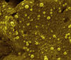 Estudian metales nanométricos con aplicaciones en medicina y energía