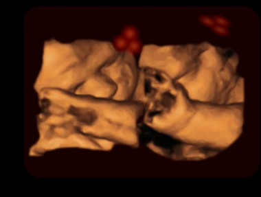 <p>Observación de un feto a través de un ultrasonido 4D. / Kirsty Dunn & Vincent Reid</p>