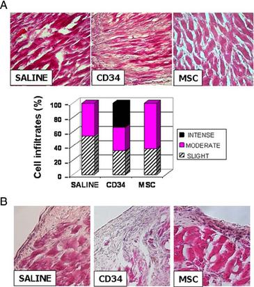 Identifican las células madre de la médula ósea eficaces para reparar el infarto de miocardio
