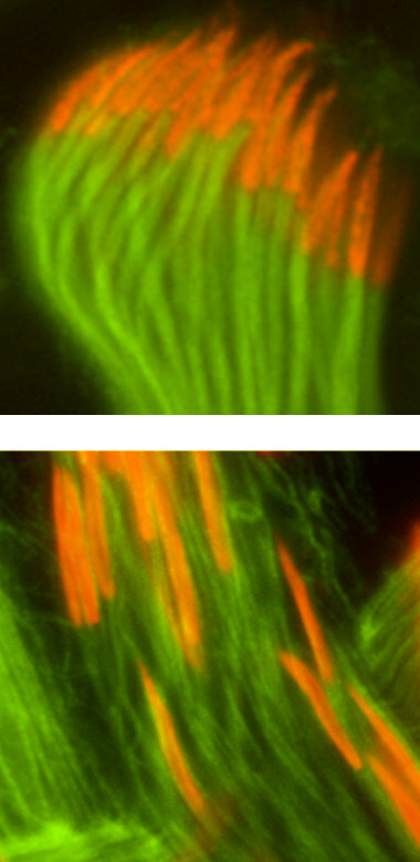 <p>Arriba: Espermatozoides de Drosophila melanogaster normal. En naranja las cabezas y en verde las colas. Abajo: Espermatozoides de Drosophila melanogaster mutante. Las cabezas han perdido la unión con el final de las colas y están desperdigadas / S. Llamazares, Gonzalez Lab</p>