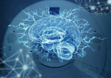 <p>Un equipo de investigadores del proyecto europeo MULTI-LATERAL ha utilizado resonancias magnéticas para estudiar las áreas cerebrales en vivo y ha refutado una teoría sobre la lateralización del lenguaje. / ©Fotolia</p>