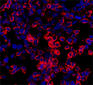 Investigadores del IMIM consiguen generar por primera vez células pancreáticas con fenotipo acinar