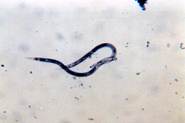 <p>Fitoparásitos juveniles de segunda etapa. Imagen: US.</p>