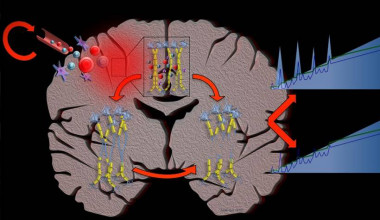 El daño autoinmune inflamatorio crónico en el cerebro produce ondas de desmielinización (línea azul en el gráfico) y pérdida axonal acumulativa (línea verde en el gráfico) en diferentes intensidades a lo largo del tiempo que conducen a todos los fenotipos de la eslerosis múltiple. / Santiago Ortiz-Perez, IDIBAPS - Hospital Clinic