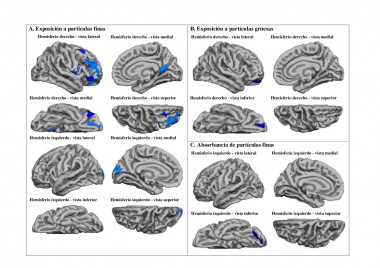 <p>En la imagen, las regiones cerebrales afectadas por las partículas finas y gruesas. / ISGlobal / Biological Psychiatry</p>