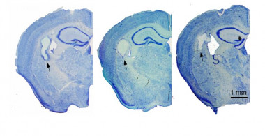 Imágenes representativas de hemisecciones cerebrales de animales trasplantados con hidrogeles de fibroína. / CTB UPM
