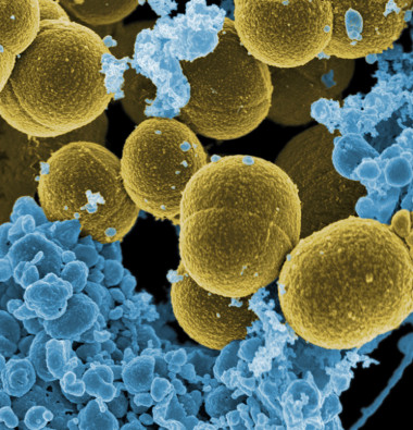 <p><em>S. aureus</em> escapando de la destrucción por células blancas humanas. / <a href="https://es.wikipedia.org/wiki/Staphylococcus_aureus#/media/File:Staphylococcus_aureus_bacteria_escape.jpg" target="_blank">Wikipedia</a></p>