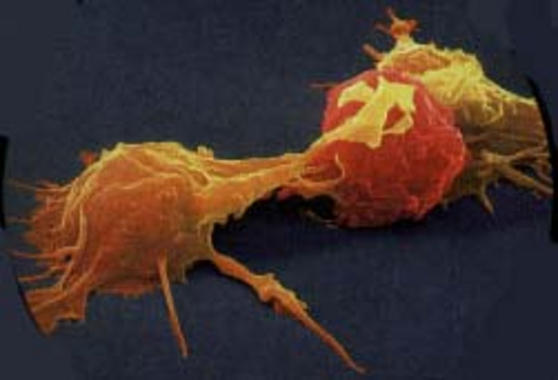 <p>Una célula tumoral es atacada por una célula NK. Foto: DICYT.</p>