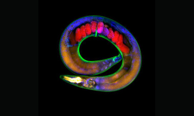 <p>Imagen del gusano C. elegans, utilizado en este estudio / Adam Klosin (CRG).</p>
