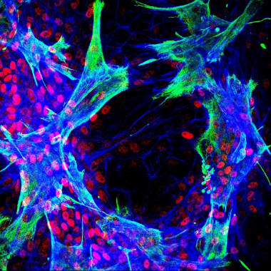 <p>Imagen de inmunofluorescencia que muestra células estrelladas hepáticas primarias humanas que interactúan con células progenitoras hepáticas bipotentes <em>in vitro</em>.<br>Los cultivos se marcaron utilizando anticuerpos contra vimentina (verde), HNF4a (rojo) y se trataron con faloidina (azul).<br>El estudio mostró que la diferenciación de las células progenitoras se localizó en los sitios de contacto entre los dos tipos de células.<br>/ Luke Noon</p>