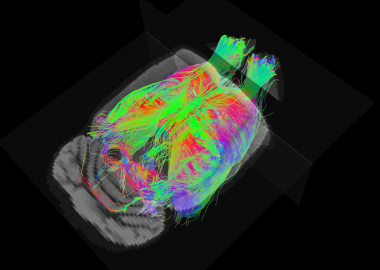Fibras cerebrales del cerebro de una rata reconstruidas mediante la técnica de Diffusion Weighted Image. / Guadalupe Soria, IDIBAPS