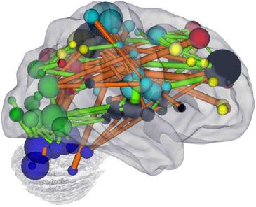 La resonancia magnética predice la madurez mental