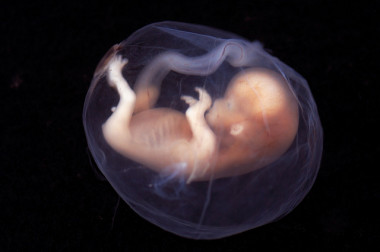 <p>Un embrión humano en la semana nueve de gestación. / <a href="https://www.flickr.com/photos/lunarcaustic/2433149102/in/photolist-4H1wsA-6acKBo-nTZgkJ-bsPcBq-4bzojK-6gL89J-JsYKsc-QqYj6-71yZLi-8kJq43-5VJrBS-nU4VZE-isrXB-6gFWtt-9Vh345-aj9P7b-9VgZx5-9VebU6-9Vebq8-9Veb1i-wYcu6u-59xbKB-oN5evf-5Av5Ej-6H3SdU-fwmYpe-dv48UB-9Marma-7X3eoF-83W4LH-71yZNk-aGrvS8-oN5ezy-bwwemB-3dPvg4-adS8Gk-vtceu-6gFWvZ-bDKNWT-aGLYyK-bDhZqX-Jj57bh-9Veaz8-bweQnE-Sau7dT-ngmPKk-Sau73x-nvPfch-65ka4o-65k965 " target="_blank">l</a><a href="https://www.flickr.com/photos/lunarcaustic/2433149102/in/photolist-4H1wsA-6acKBo-nTZgkJ-bsPcBq-4bzojK-6gL89J-JsYKsc-QqYj6-71yZLi-8kJq43-5VJrBS-nU4VZE-isrXB-6gFWtt-9Vh345-aj9P7b-9VgZx5-9VebU6-9Vebq8-9Veb1i-wYcu6u-59xbKB-oN5evf-5Av5Ej-6H3SdU-fwmYpe-dv48UB-9Marma-7X3eoF-83W4LH-71yZNk-aGrvS8-oN5ezy-bwwemB-3dPvg4-adS8Gk-vtceu-6gFWvZ-bDKNWT-aGLYyK-bDhZqX-Jj57bh-9Veaz8-bweQnE-Sau7dT-ngmPKk-Sau73x-nvPfch-65ka4o-65k965 " target="_blank">unar caustic</a></p>
