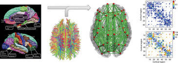 Modelos de cerebro