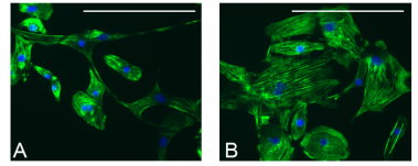 <p>Inmunocitoquímica de cardiomiocitos. Panel A: cardiomiocitos de individuos sanos. Tinción citoplasmática de troponina C (verde) y tinción nuclear con dapi (azul). Panel B: Aumento del tamaño de cardiomiocitos de pacientes con el síndrome cardio-facio-cutáneo. / UEx</p>
