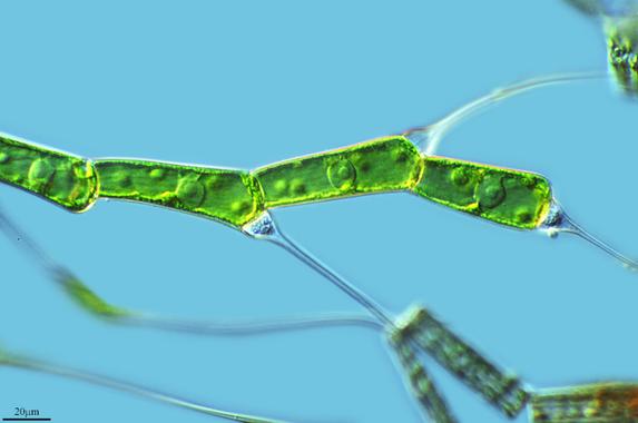 <p>La cianobacteria de la que surgieron las plantas se remonta a 1.500 millones de años. / Proyecto Agua (CC BY-NC-SA 2.0).</p>