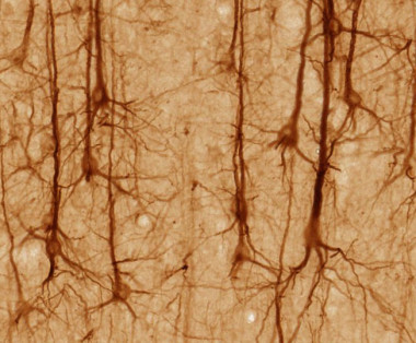 <p>Neuronas vistas al microscopio. / <a href="http://upload.wikimedia.org/wikipedia/commons/3/32/Smi32neuron.jpg" target="_blank">Wikipedia</a>.</p>