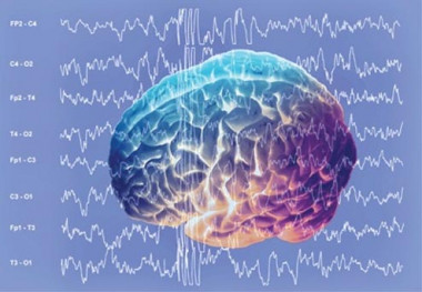 <p>Escáner cerebral. / UPF</p>
