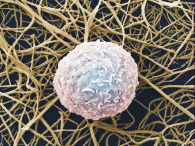 Los leucocitos, también llamados glóbulo blanco, son las células responsables de la respuesta autoinmune. / Wellcome images.</p>