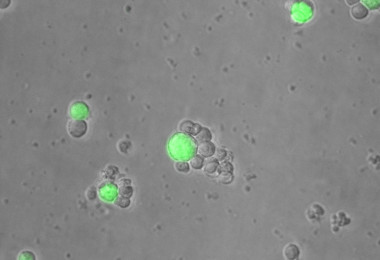 <p>Los linfocitos T (en gris) del sistema inmune rodean a las células tumorales (en verde) gracias a la acción de los anticuerpos BiTE secretados por el adenovirus oncolítico. / SINC</p>