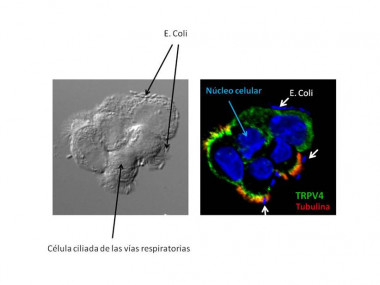 Ataque de bacterias Escherichia coli a las células ciliadas del pulmón. En la imagen de la izquierda se aprecian varias células ciliadas del pulmón rodeadas por bacterias. En la imagen de la derecha se utilizan marcadores fluorescentes en diferentes colores para identificar el DNA (azul) del núcleo de las células ciliadas  y las bacterias, el canal TRPV4 (verde) y la tubulina (rojo), una proteína presente en los cilios. / UPF
