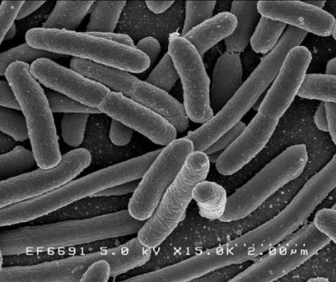 <p><em>Escherichia Coli</em>, una de las muchas bacterias presentes en el intestino. / NIAID / <a href="http://en.wikipedia.org/wiki/File:EscherichiaColi_NIAID.jpg" target="_blank">Wikipedia</a></p>