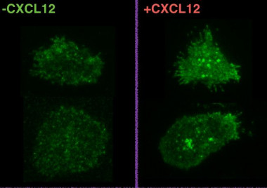 <p>Imágenes obtenidas por microscopía de reflexión interna total de células expresando CXCR4 (spots verdes) en ausencia (izquierda) o en presencia del ligando (derecha) / Laura Martínez-Muñoz L. et al. </p>