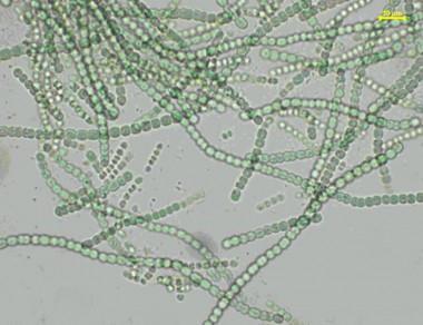 <p class=" text-center">Las cianobacterias, de vital importancia para el equilibrio del medioambiente, son algunos de los microorganismos afectados por la combinación de residuos de productos farmacéuticos. /UAM-UAH</p>