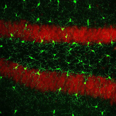 <p>La imagen, utilizada en el estudio, muestra células microgliales (formas verdes) / (c) Dr. Diego Gómez-Nicola (Universidad de Southampton).</p>
