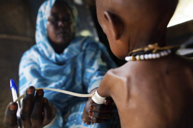 <p>Una enfermera mide el grosor del brazo de un niño con malnutrición. / Albert González / Unamid</p>