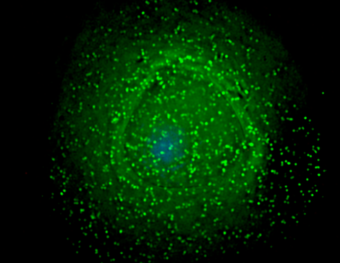 <p>El virus en la superficie de un macrófago –células del sistema inmunitario– infectado. / <a href="http://en.wikipedia.org/wiki/File:HIV_on_macrophage.png" target="_blank">Wikipedia</a></p>