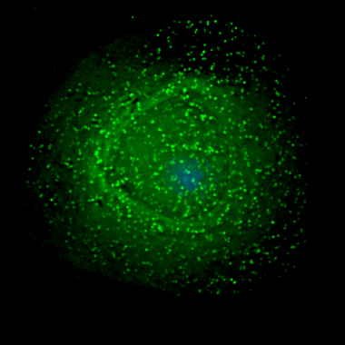 <p class=" text-left">En la imagen puede verse al VIH penetrando en la superficie de un macrófago infectado. / <a href="https://en.wikipedia.org/wiki/HIV#/media/File:HIV_on_macrophage.png" target="_blank">Wikipedia</a></p>