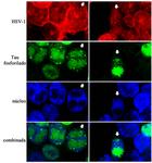Células de neuroblastoma humano infectadas con HSV-1.
