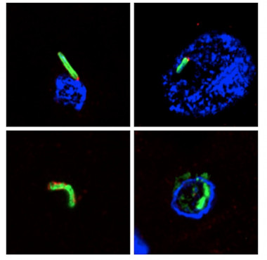 Visualización directa de estructuras bacterianas utilizando anticuerpos específicos en cortes de tejido cerebral de pacientes de EA. La observación directa de bacterias se ha realizado mediante inmunohistoquímica y microscopía confocal. / UAM