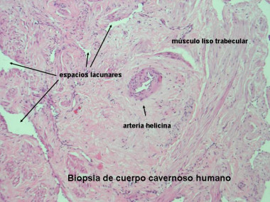 <p>Figura: Microfotografía de un corte histológico de cuerpo cavernoso</p>