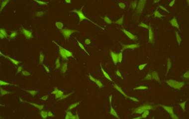 <p>Células en desarrollo sobre una lámina biofuncionalizada. / UPM</p>