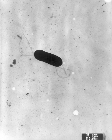 <p>Bacteria <em>Lysteria monocytogenes.</em> Imagen: <a href="http://upload.wikimedia.org/wikipedia/commons/7/74/Listeria_monocytogenes_PHIL_2287_lores.jpg" target="_blank">Wikipedia</a>.</p>