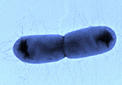 E. Coli. Imagen: UB