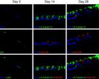 Differentiation of human nasal polyp pseudostratified epithelium from epithelial stem cells in ALI culture