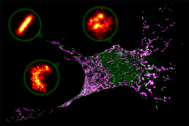 <p>Imagen de microscopía confocal donde se observa una célula de mamífero entrando en apoptosis o suicidio celular.  Las mitocondrias se muestran en magenta y la proteína Bax en verde, organizada en zonas donde las mitocondrias se están fragmentando. Los detalles o <em>zooms</em> son estructuras de Bax (en naranja) captadas por microscopía de superresolución en forma de anillos, arcos y líneas. / R. Salvador-Gallego</p>