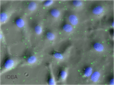 Patentan una terapia con nanopartículas para paliar el síndrome de ojo seco