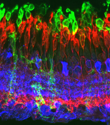 <p>Imagen histológica de la retina de un animal rd10 al mes de edad, en la que se observa una alteración importante de la capa de los fotorreceptores de la retina. / UMH</p>