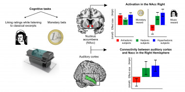 <p>Correlatos neurales de la anhedonia musical específica. / IDIBELL</p>