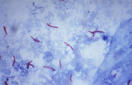 Sintetizan compuestos de hierro para luchar contra la tuberculosis