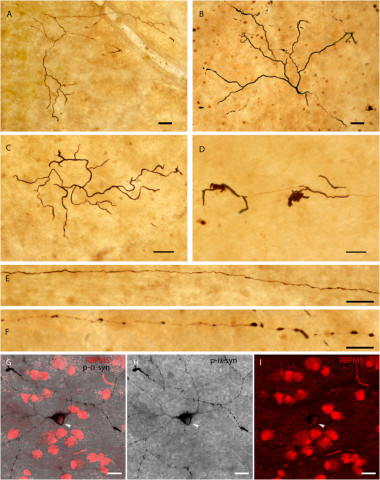 Figura estructuras inmunorreactivas en retinas. / Movement Disorders 