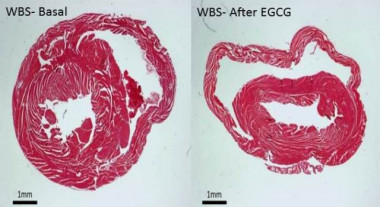 Secciones histológicas de la pared ventricular del corazón de modelos de WBS. / UPF.