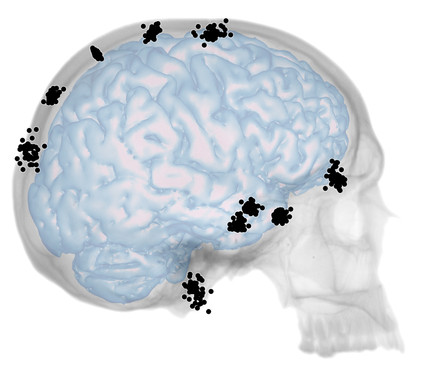 <p>Según el estudio las dos áreas de la cavidad craneal varían de forma independiente y es probable que, en el registro fósil, nos estén indicando efectos distintos de nuestra evolución cerebral. /  Bruner <em>et al</em>. / CENIEH</p>