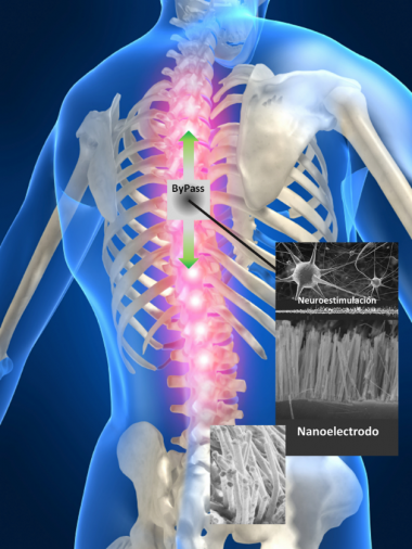 <p>Esquema del by-pass que van a desarrollar los investigadores para aplicarlo en lesiones medulares. / IMDEA Nanociencia</p>