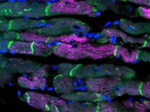 <p>Células miocárdicas de un corazón de ratón adulto. Se ha detectado, mediante anticuerpos, la distribución de dos proteínas, la desmina del esqueleto celular (en púrpura) y la conexina-43, que forma parte de las uniones gap que comunican los miocardiocitos entre sí (en verde). Los núcleos celulares aparecen en azul.</p>