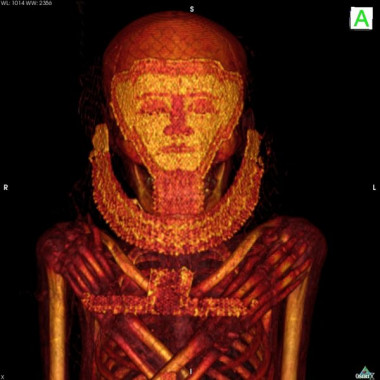 <p>Imagen de una de las momias analizadas, obtenida gracias al uso del escáner / Universidad de Granada</p>
